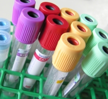 bloodsamples